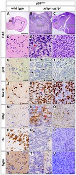 HuC/HuD Antibody in Immunohistochemistry (IHC)