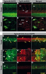 HuC/HuD Antibody in Immunohistochemistry (IHC)