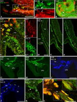 HuC/HuD Antibody in Immunohistochemistry (Paraffin) (IHC (P))
