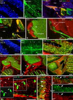 HuC/HuD Antibody in Immunohistochemistry (Paraffin) (IHC (P))