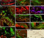 HuC/HuD Antibody in Immunohistochemistry (Paraffin) (IHC (P))