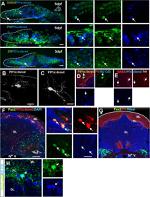 HuC/HuD Antibody in Immunohistochemistry (IHC)