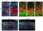 HuC/HuD Antibody in Immunohistochemistry (Paraffin) (IHC (P))