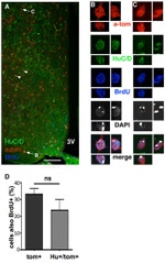 HuC/HuD Antibody in Immunohistochemistry (IHC)