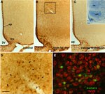 HuC/HuD Antibody in Immunohistochemistry (IHC)