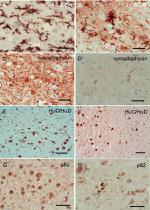 HuC/HuD Antibody in Immunohistochemistry (IHC)