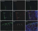 HuC/HuD Antibody in Immunohistochemistry (IHC)