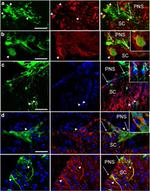 HuC/HuD Antibody in Immunohistochemistry (IHC)