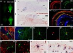 HuC/HuD Antibody in Immunohistochemistry (IHC)