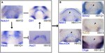 HuC/HuD Antibody in Immunohistochemistry (IHC)