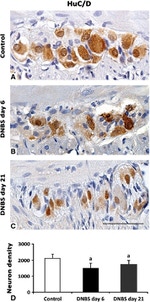 HuC/HuD Antibody in Immunohistochemistry (IHC)