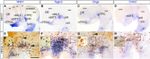 HuC/HuD Antibody in Immunohistochemistry (IHC)