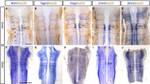 HuC/HuD Antibody in Immunohistochemistry (IHC)