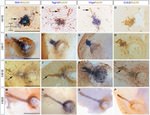 HuC/HuD Antibody in Immunohistochemistry (IHC)