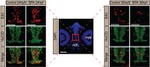HuC/HuD Antibody in Immunohistochemistry (IHC)