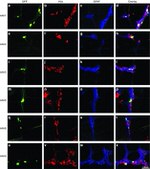 HuC/HuD Antibody in Immunohistochemistry (IHC)