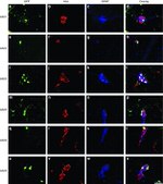 HuC/HuD Antibody in Immunohistochemistry (IHC)