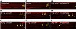 HuC/HuD Antibody in Immunohistochemistry (IHC)