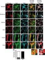 HuC/HuD Antibody in Immunohistochemistry (IHC)
