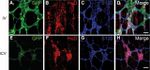 HuC/HuD Antibody in Immunohistochemistry (IHC)