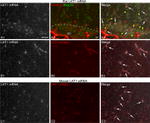 HuC/HuD Antibody in Immunohistochemistry (IHC)