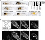 HuC/HuD Antibody in Immunohistochemistry (IHC)