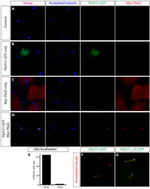 GFP Antibody in Immunocytochemistry (ICC/IF)