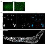 GFP Antibody in Immunocytochemistry (ICC/IF)