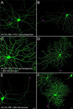 GFP Antibody in Immunocytochemistry (ICC/IF)