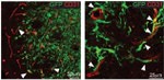 GFP Antibody in Immunohistochemistry (IHC)