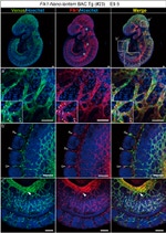 GFP Antibody in Immunohistochemistry, Immunocytochemistry (IHC, ICC/IF)