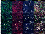 GFP Antibody in Immunohistochemistry (IHC)