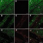 GFP Antibody in Immunohistochemistry (IHC)