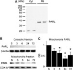 OxPhos Complex IV subunit IV Antibody in Western Blot (WB)