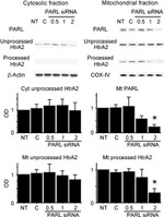 OxPhos Complex IV subunit IV Antibody in Western Blot (WB)