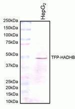 HADHB Antibody in Western Blot (WB)