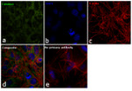 Catalase Antibody in Immunocytochemistry (ICC/IF)