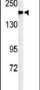 A2ML1 Antibody in Western Blot (WB)