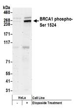 Phospho-BRCA1 (Ser1524) Antibody in Western Blot (WB)