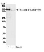 Phospho-BRCA1 (Ser1189) Antibody in Western Blot (WB)