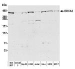 BRCA2 Polyclonal Antibody