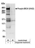 Phospho-BRCA1 (Ser1423) Antibody in Western Blot (WB)