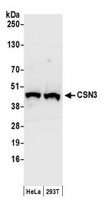 CSN3 Antibody in Western Blot (WB)