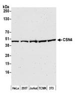CSN4 Polyclonal Antibody