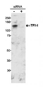 GTF2I/TFII-I Antibody in Western Blot (WB)