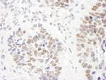 MSH6 Antibody in Immunohistochemistry (Paraffin) (IHC (P))