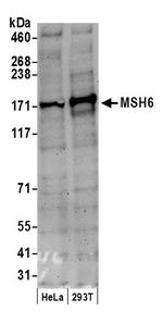 MSH6 Antibody in Western Blot (WB)