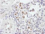 MSH6 Antibody in Immunohistochemistry (Paraffin) (IHC (P))