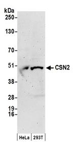 CSN2 Antibody in Western Blot (WB)