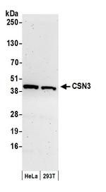 CSN3 Polyclonal Antibody